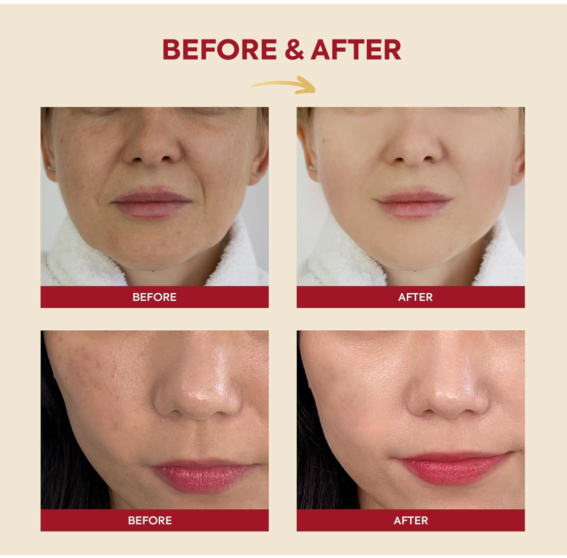 K-secret Seoul 1988 Essence Snail Mucin 97% Rice 100ml