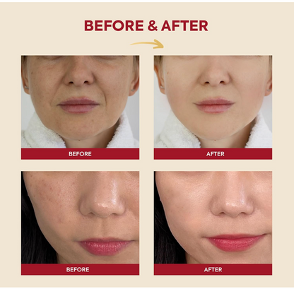 K-secret Seoul 1988 Essence Snail Mucin 97% Rice 100ml