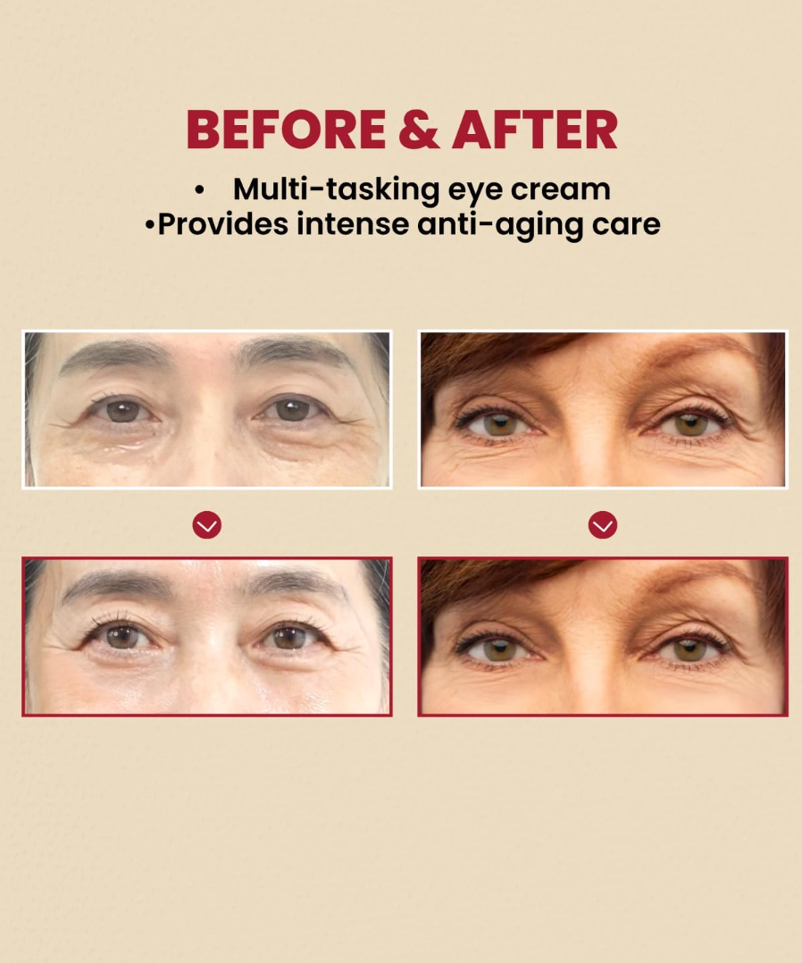 K-secret Seoul 1988 Crema de ojos Retinol 4% 30 ml