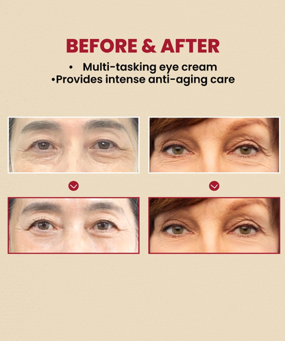 K-secret Seoul 1988 Crema de ojos Retinol 4% 30 ml