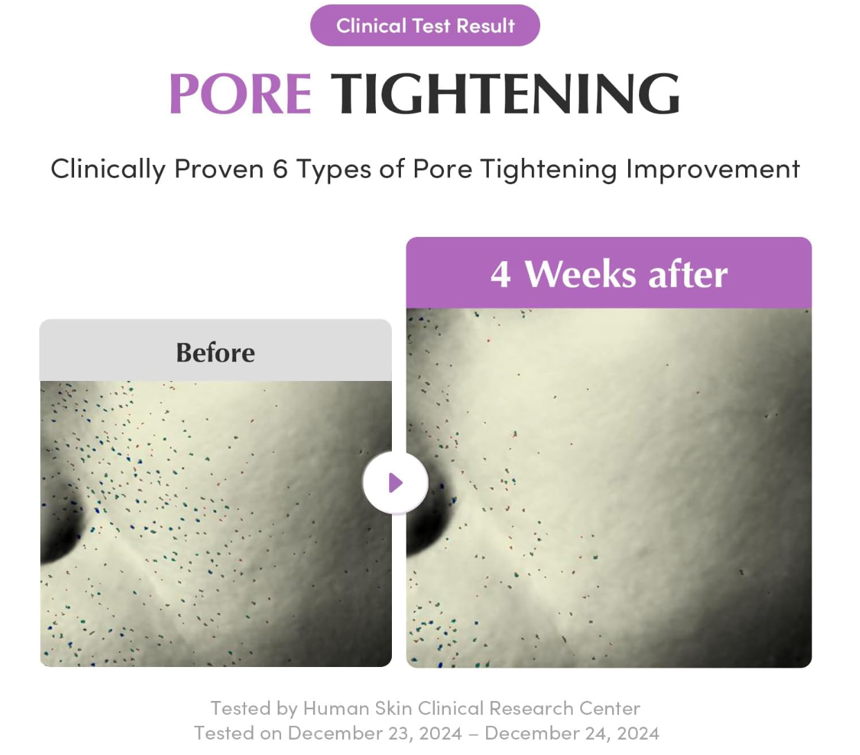 Eqqualberry Purple PDRN Pore Minimizing Serum 30ml