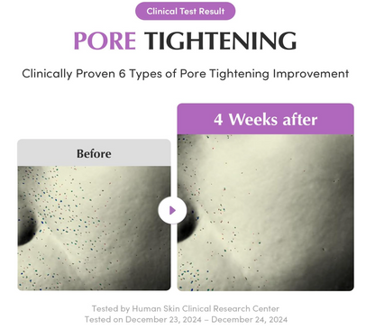 Eqqualberry Purple PDRN Pore Minimizing Serum 30ml