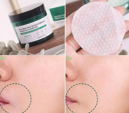 Some By Mi AHA BHA PHA 30 Days Miracle Truecica Clear Pad