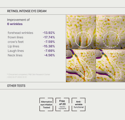 Some By Mi Retinol Intense Trial Kit