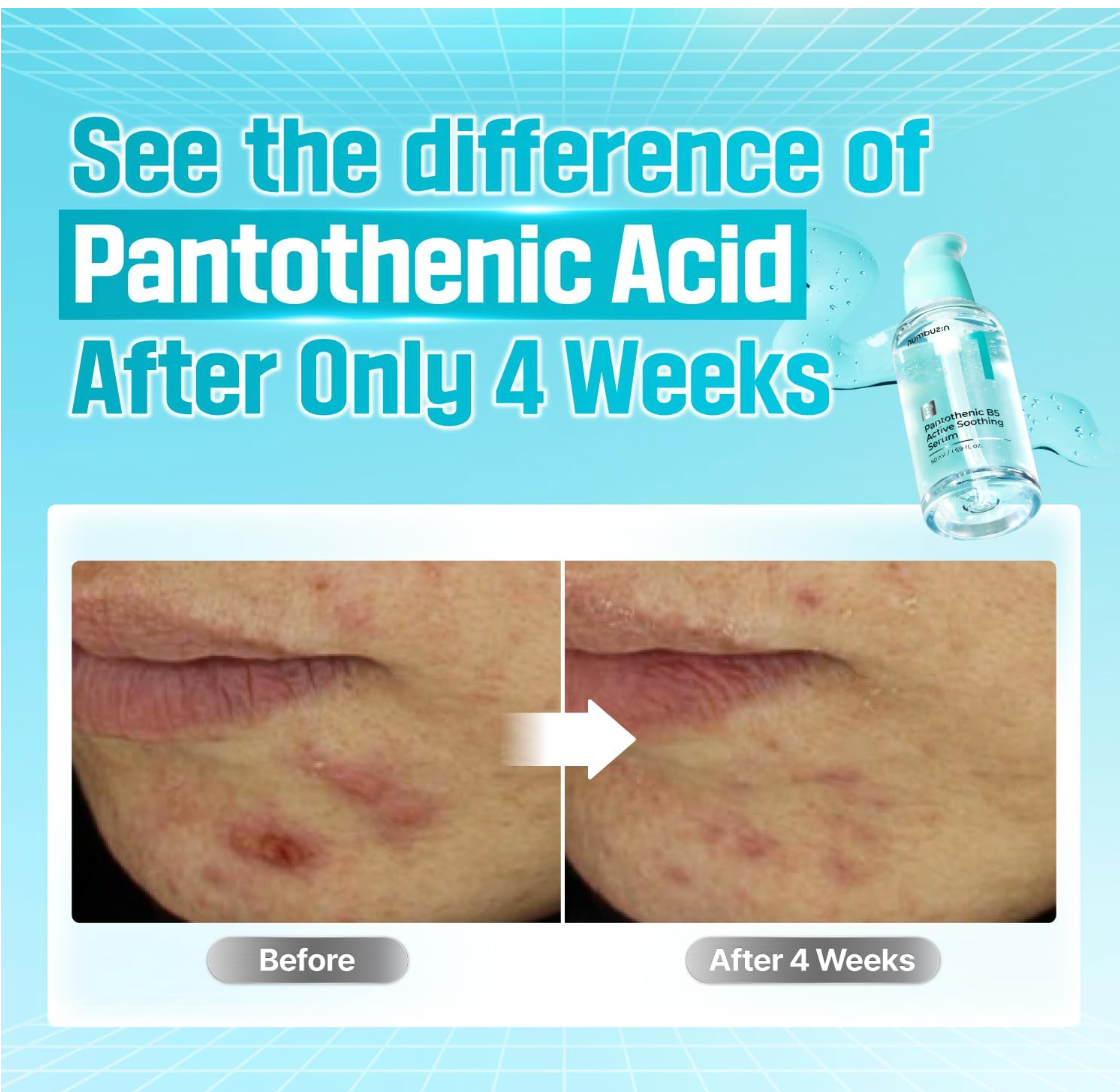 Numbuzin No. 1 Panthotenic B5 Active Serum 50ml