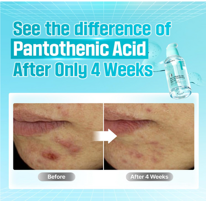 Numbuzin No. 1 Panthotenic B5 Active Serum 50ml