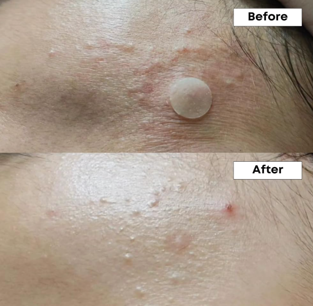 Nineless Azelaic Acid Serum 30ml